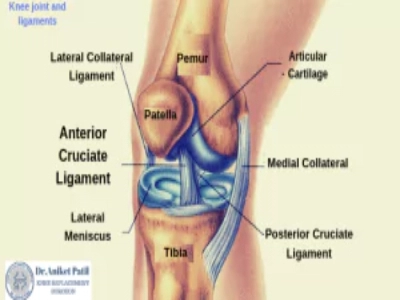 ACL surgery in Pcmc