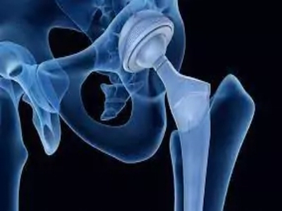 Hip replacement in pune pcmc